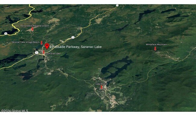 Photo - 63 Palisade Pky