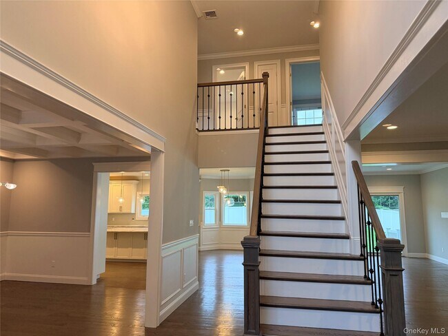 28 Fern Dr E