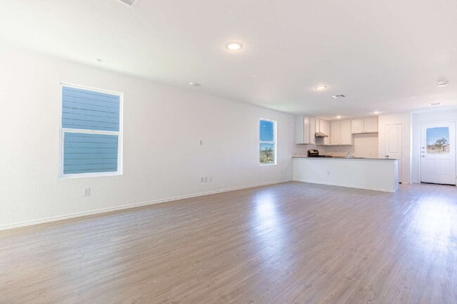 Photo - 9143 Coronal Rings