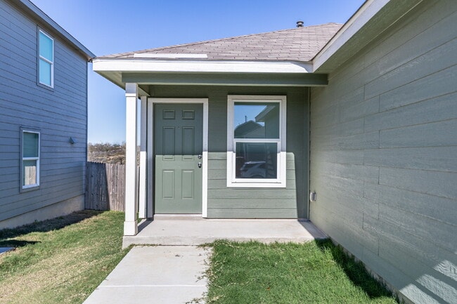 Photo - 9143 Coronal Rings