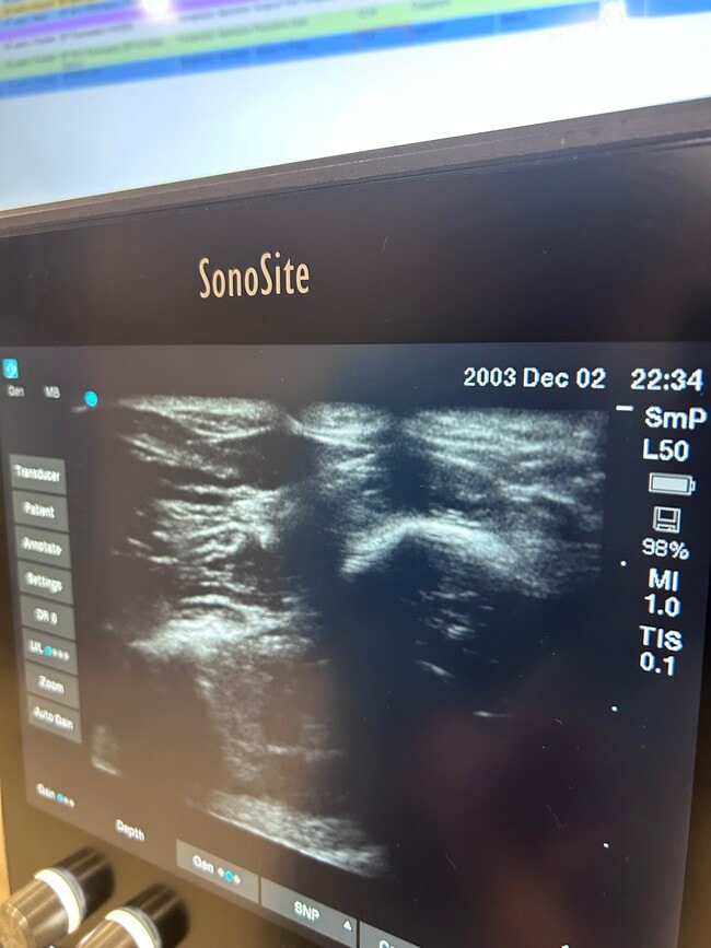 Photo - 15101 Callohan Ct