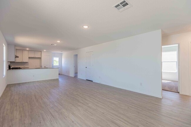 Photo - 9143 Coronal Rings