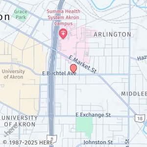Building Photo - 585 E Buchtel Ave