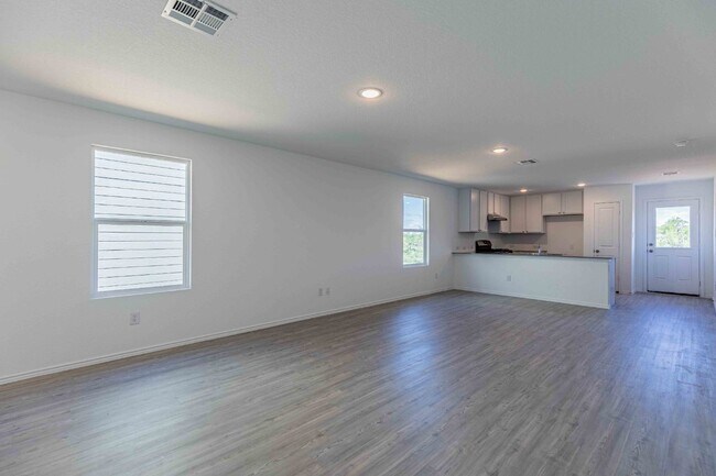 Photo - 9143 Coronal Rings